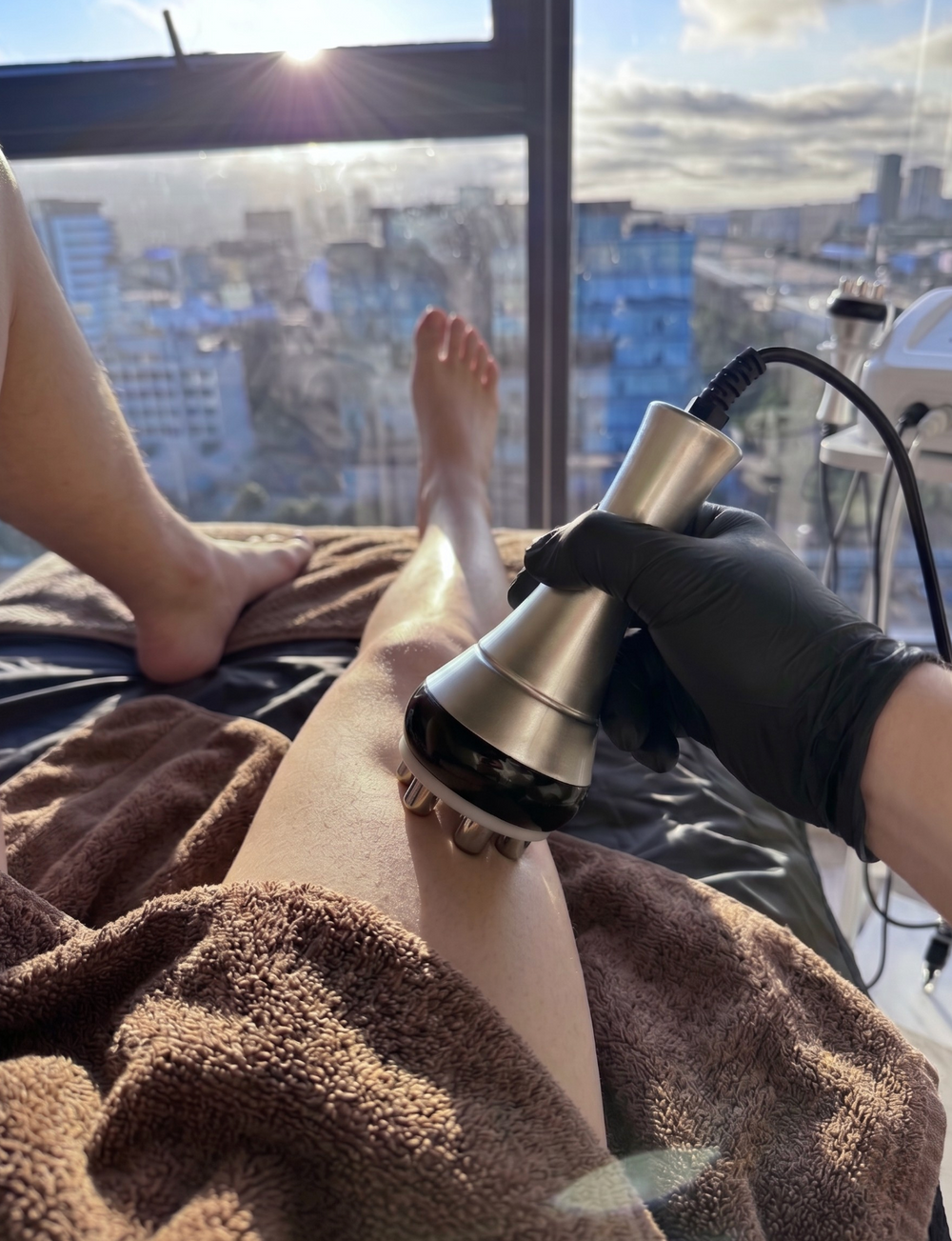 Radiofrecuencia Piernas