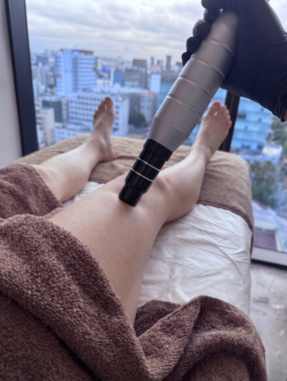 Eliminación Tatuaje Piernas