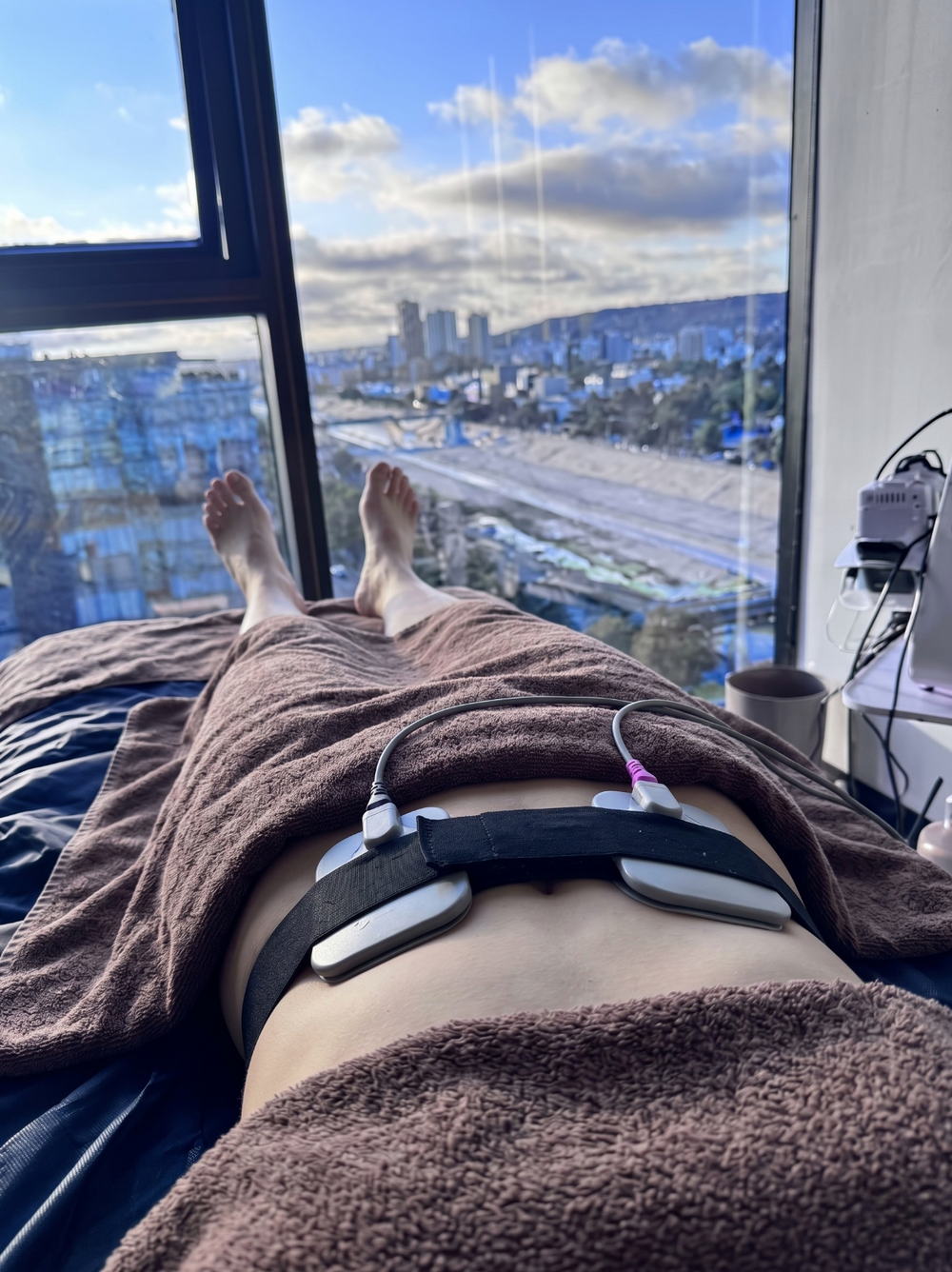 Emsculpt Abdomen